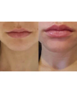 24HR Lip Treatment System -Huda Beauty Store ESHH0003F 6b