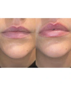 The Official Lip Doctor Kit 14 The Official Lip Doctor Kit -Huda Beauty Store ESHH0003F 6c