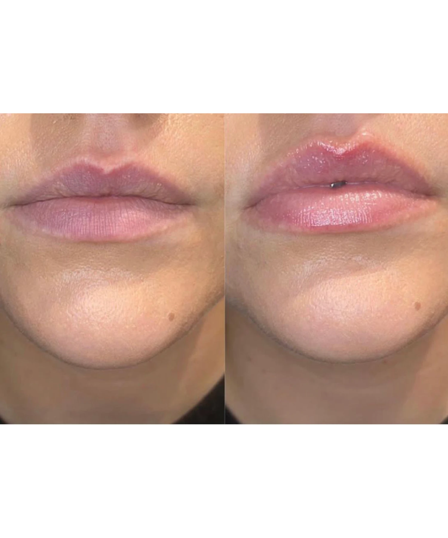 The Official Lip Doctor Kit 8 The Official Lip Doctor Kit - Image 6