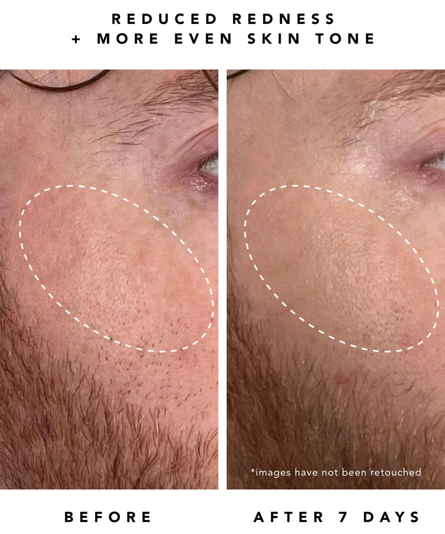 Nova 15% Vitamin C + Turmeric Brightening Serum 5 Nova 15% Vitamin C + Turmeric Brightening Serum - Image 3