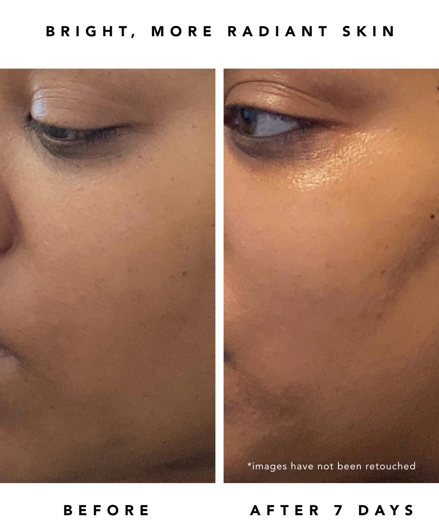 Nova 15% Vitamin C + Turmeric Brightening Serum 6 Nova 15% Vitamin C + Turmeric Brightening Serum - Image 4