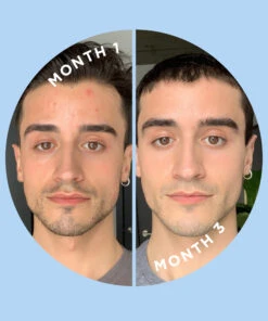 KILLA™ & SKIN DISCIPLINE™ Duo -Huda Beauty Store ZITS0004F 6a