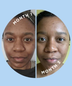 KILLA™ & SKIN DISCIPLINE™ Duo -Huda Beauty Store ZITS0004F 6b